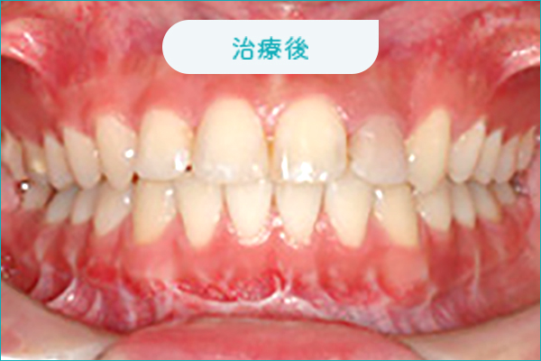 治療後