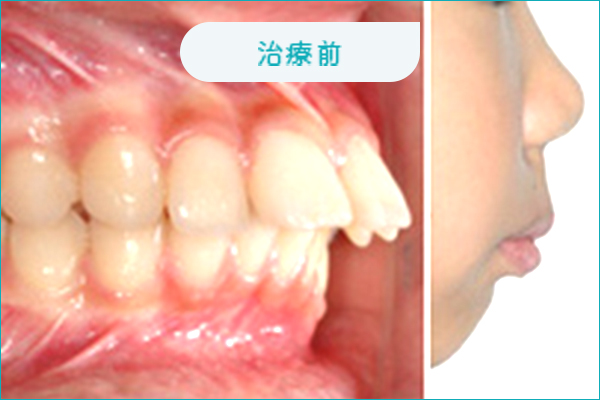 治療前