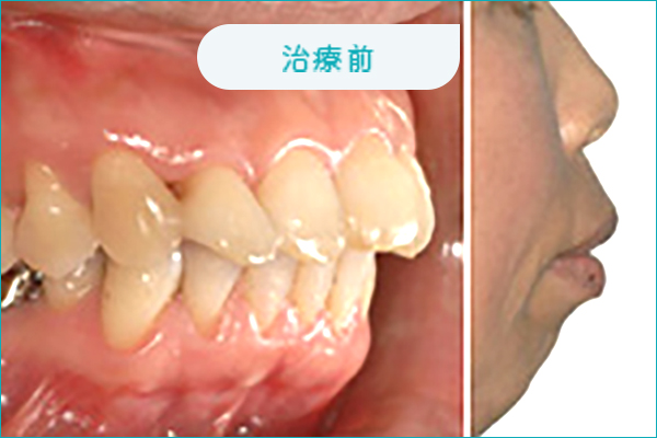治療前