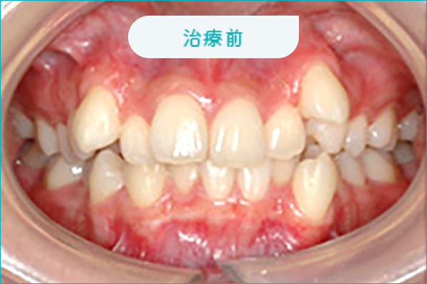治療前