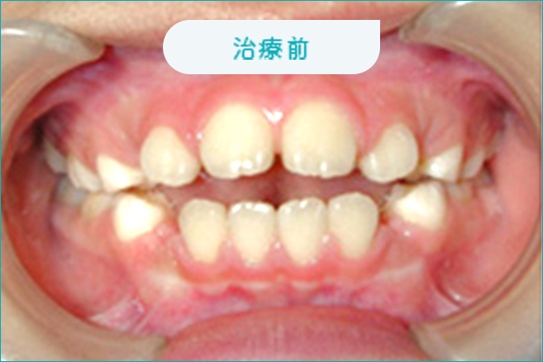 治療前