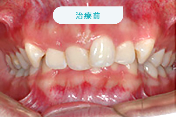 治療前